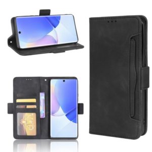 For Huawei nova 9 Skin Feel Calf Pattern Horizontal Flip Leather Phone Case with Holder & Card Slots & Photo Frame(Black) (OEM)