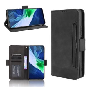 For Infinix Note 10 Skin Feel Calf Pattern Horizontal Flip Leather Case with Holder & Card Slots & Photo Frame(Black) (OEM)