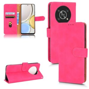 For Honor X9 5G/X30/Magic4 Lite Skin Feel Magnetic Flip Leather Phone Case(Rose Red) (OEM)