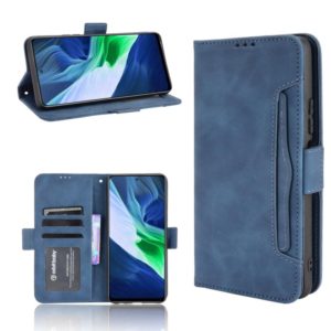 For Infinix Note 10 Skin Feel Calf Pattern Horizontal Flip Leather Case with Holder & Card Slots & Photo Frame(Blue) (OEM)